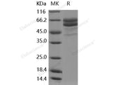 Recombinant Human FAM20C/DMP4 Protein (His Tag)