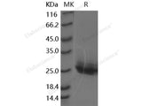 Recombinant Human Frizzled-10/FZD10 Protein (His Tag)