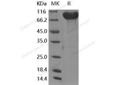 Recombinant Human CADM4/IGSF4C/NECL-4 Protein (Fc Tag)