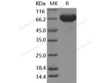 Recombinant Human A1BG/alpha 1B-Glycoprotein Protein (His Tag)