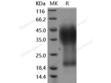 Recombinant Human GYPA/CD235a/Glycophorin A Protein (His Tag)