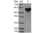 Recombinant Human Secretogranin 3/SCG3 Protein (His Tag)