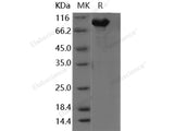 Recombinant Human KIAA1279 Protein (His & GST Tag)