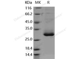 Recombinant Human RAB27B Protein (His Tag)