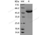 Recombinant Human RAB27B Protein (Fc Tag)