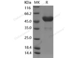 Recombinant Human Frizzled-6/FZD6 Protein (Fc Tag)