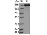 Recombinant Human NFASC/Neurofascin protein (His Tag)