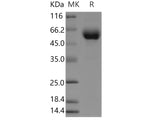 Recombinant Human EDEM2/C20orf31 Protein (His Tag)