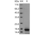 Recombinant Human TSPAN8/Tetraspanin 8 Protein (His Tag)