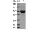 Recombinant Human TSPAN8/Tetraspanin 8 Protein (Fc Tag)