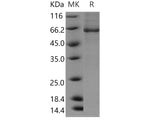 Recombinant Human BBOX1/Gamma-BBH Protein (His & GST Tag)