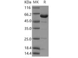 Recombinant Human NCF2/P67phox Protein