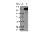 Recombinant Human NCF2/P67phox Protein (His & GST Tag)