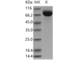 Recombinant Human Biotinidase/BTD Protein (His Tag)(Active)