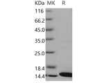 Recombinant Human COX5B Protein (His Tag)