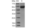 Recombinant Human Cbl-c/CBL-3 Protein (His & GST Tag)