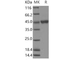 Recombinant Human Gastric Lipase/LIPF Protein (Baculovirus, His Tag)