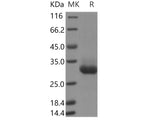 Recombinant Human RAB11B Protein (His Tag)