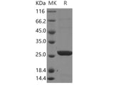 Recombinant Human Glutathione S-transferase theta-2B/GSTT2B Protein (His Tag)