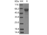 Recombinant Human TRAP-alpha/SSR1 Protein (Fc Tag)