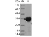 Recombinant Human GPD1/GDP-C Protein (E.coli, His Tag)