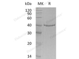 Recombinant Human GMPR Protein (E.coli, His Tag)