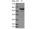 Recombinant Human LAP3/Cytosol Aminopeptidase Protein (His Tag)