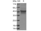 Recombinant Human TAPBP/ Tapasin Protein (His Tag)