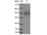 Recombinant Human EDNRB/Endothelin B Receptor Protein (Fc Tag)