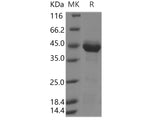 Recombinant Human Neurotensin Protein (Fc Tag)