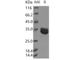 Recombinant Human Annexin A8/ANXA8 Protein (His Tag)