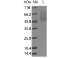 Recombinant Human PARM1/PARM-1 Protein (His Tag)