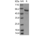 Recombinant Human PSG6/PSG10 Protein (His Tag)