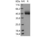 Recombinant Human DPEP2 Protein (His Tag)