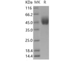 Recombinant Human DPEP2 Protein (Fc Tag)