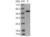 Recombinant Human Calsequestrin-1/CASQ1 Protein