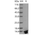 Recombinant Human DNAJC30 Protein (His Tag)