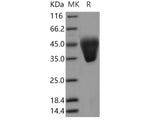 Recombinant Human KCT2/C5orf15 Protein (His Tag)