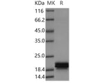 Recombinant Human CNPY2 Protein (His Tag)