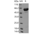 Recombinant Human GALNT2/GalNAc-T2 Protein (His Tag)