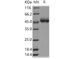 Recombinant Human FAM171B/KIAA1946 Protein (His Tag)