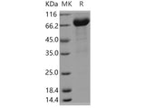 Recombinant Human FAM171B/KIAA1946 Protein (Fc Tag)