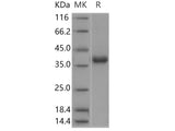 Recombinant Human Glutaminyl cyclase/QPCT Protein (His Tag)