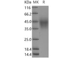 Recombinant Human TMEM25 Protein (His Tag)