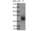 Recombinant Human RAMP3 Protein (Fc Tag)