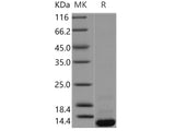 Recombinant Human BOLA1 Protein (His Tag)