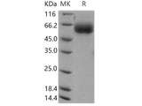 Recombinant Human AMIGO2 Protein (aa 1-398, His Tag)