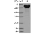 Recombinant Human APLP-1 Protein (aa 1-580, His Tag)