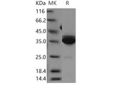 Recombinant Human Statherin/STATH Protein (Fc Tag)