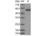 Recombinant Human Galactolipase/PLRP2 Protein (His Tag)
